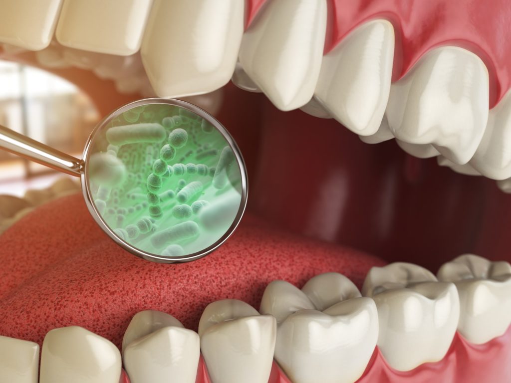 Illustration of a small dental mirror inside a mouth reflecting the bacteria that causes halitosis/bad breath