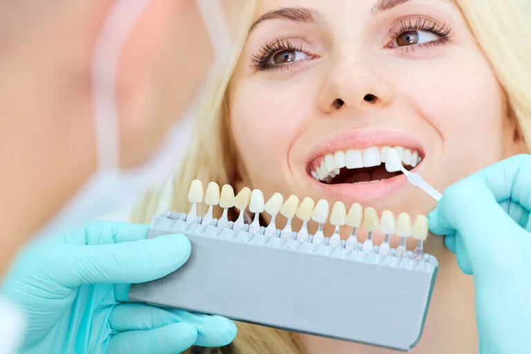 Dentist using a shade guide to match a patient's tooth color for a dental veneer or whitening treatment.