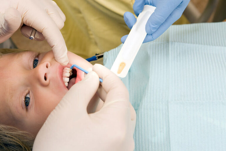 Dentist applying fluoride treatment to a young child's teeth during a dental visit.