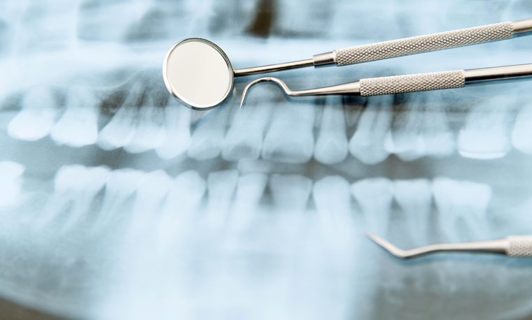 Dental tools, including a mirror and probe, placed on top of a dental X-ray showing a full set of teeth.