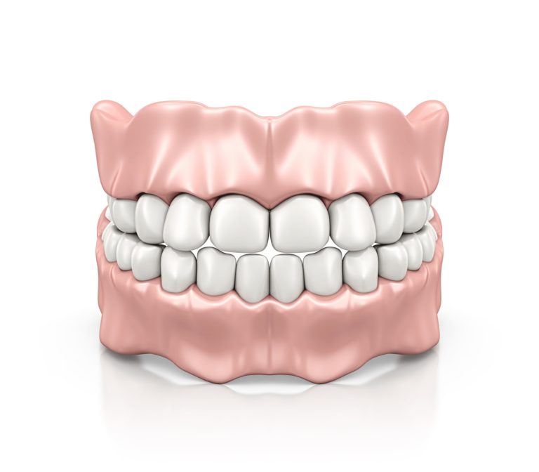 Dentures model including gums and teeth from capital dental in lincoln nebraska