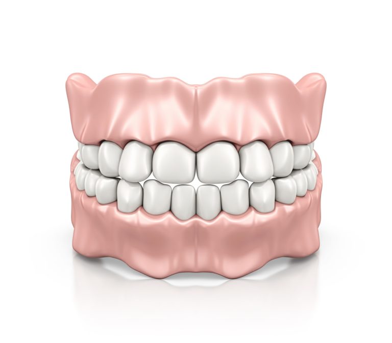 Dentures model including gums and teeth from capital dental in lincoln nebraska