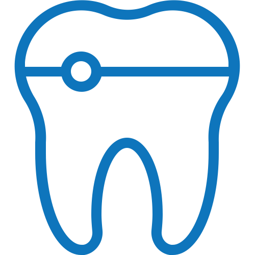 Dental Veneers