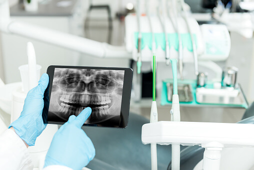 doctor pointing at xray of teeth